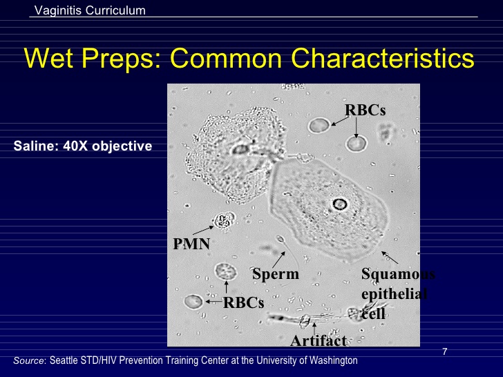 Medical Outlines Trichomonas
