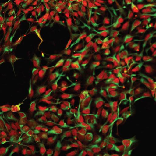 الخلايا الجذعية ستنقذ المصابين بأمراض الميتوكوندريا