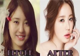 Uk Celebrity Gossip New Magazine ~ : Korean Actresses Plastic Surgery