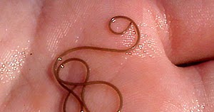 Springfield Plateau: Horse Hair Worm