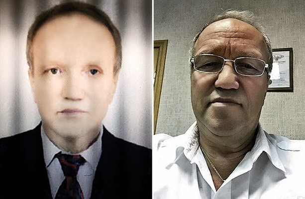 white man turns black liver transplant