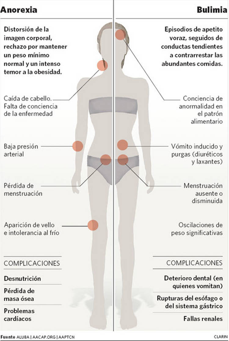 esqueci a ANA [anorexia bulimia]:Bulimia e Anorexia (Algumas