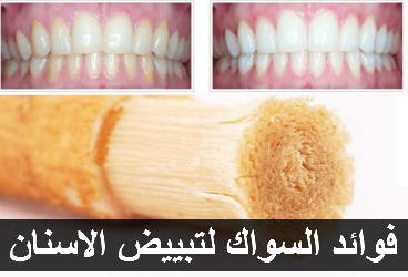 فوائد السواك لتبييض الاسنان