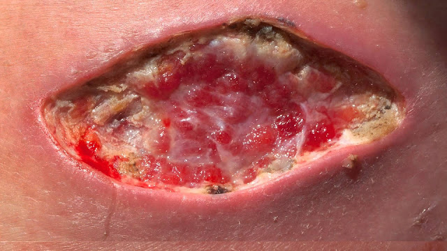 7 early signs of Cancer that you shouldn't ignore! 7 early signs of Cancer that you shouldn't ignore!