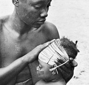 Mangbetu infant with head binding