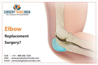 Elbow Replacement Surgery in India