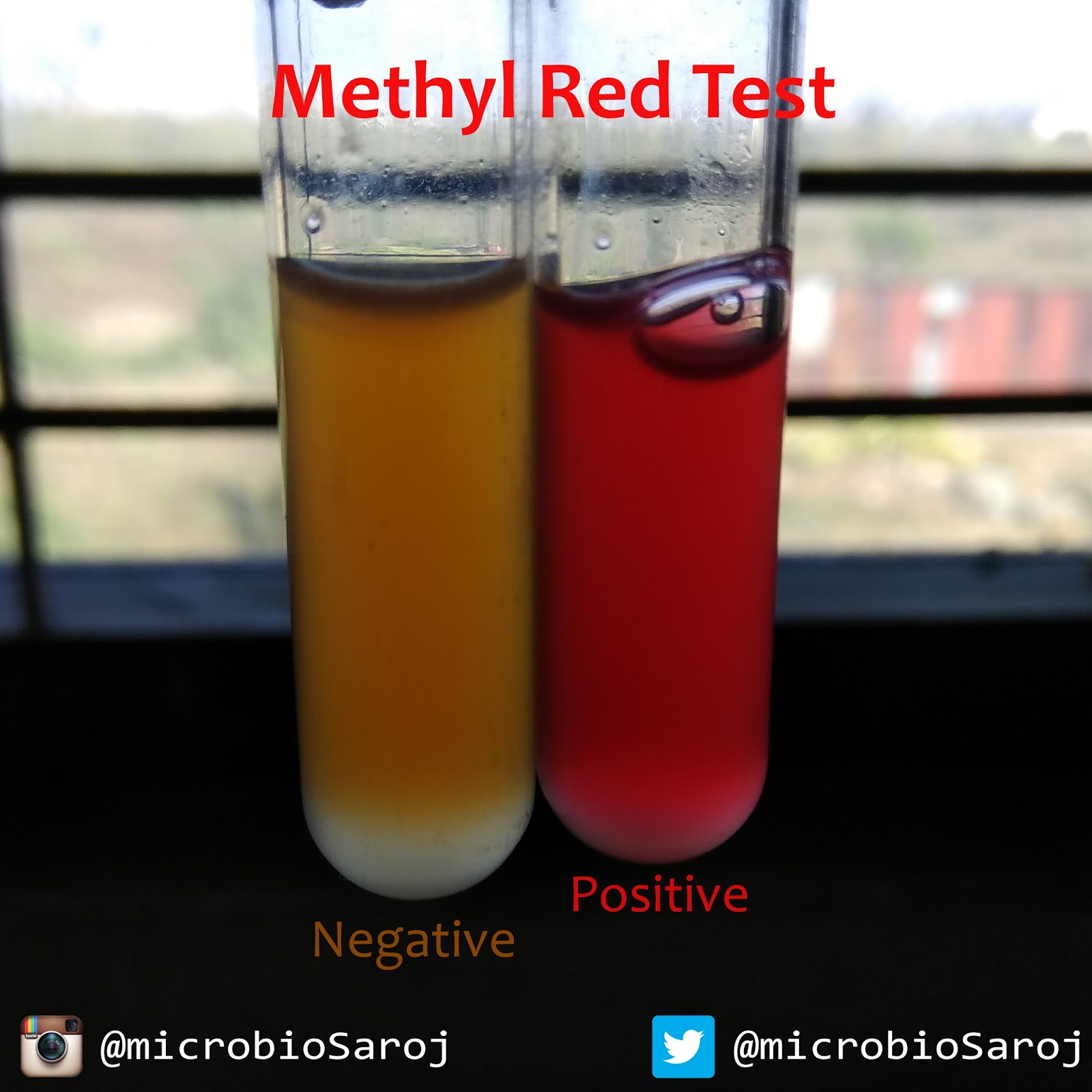 IATSOM I am the Student of Microbiology Biochemical Tests