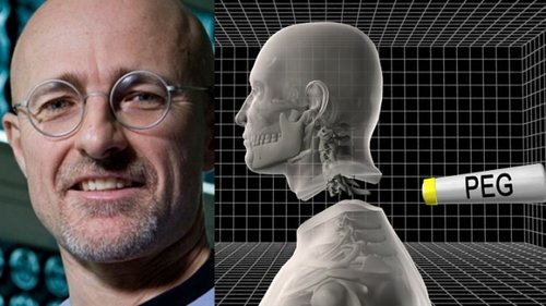 Italian doctor wants to transplant a human head, and it's not a joke!