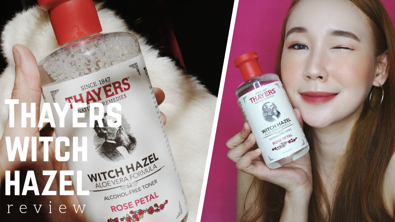 Witch acne will hazel help 8 Benefits