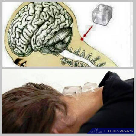 Viral Tips Hilangkan Sakit Kepala Migrain Mengunakan Ais