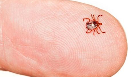 Home Remedies For Chiggers Home Remedies For Chiggers