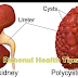 How To Know If You Have Kidney Problems | seven signs 