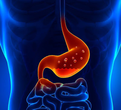 Acidity in stomach