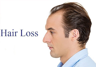 Hair Loss Clinic In Noida Hair Loss Treatment Cost In Delhi Hair