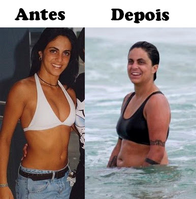 Thammy Gretchen Antes E Depois