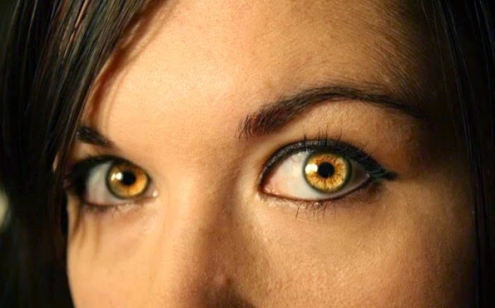 Κίτρινα μάτια: Πάνω από 10 διαφορετικές παθήσεις εκδηλώνονται με το σύμπτωμα