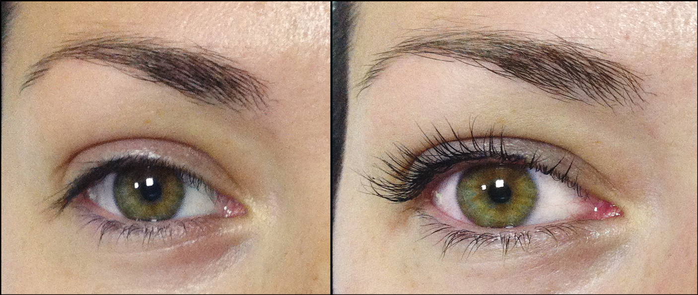 Silvena Make Up Laminirane Boyadisvane I Botoks Na Migli