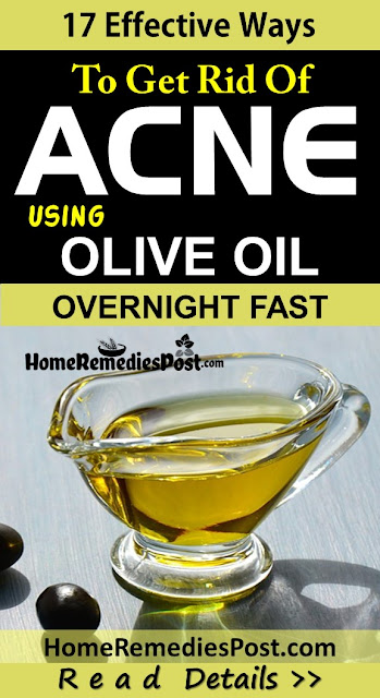 Olive Oil For Acne, Olive Oil Acne, Is Olive Oil Good For Acne, Olive Oil And Acne, How To Use Olive Oil For Acne, How To Get Rid Of Acne With Olive Oil, How To Get Rid Of Acne, How To Get Rid Of Acne Fast, 