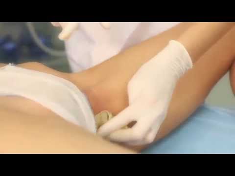 Pubic Hair Removel Pubic Hair Removal 10 Tips To Help You With