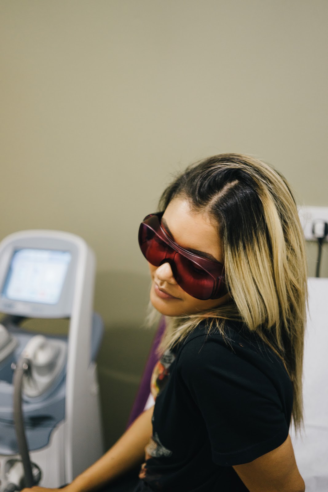 My Laser Hair Removal Journey So Far // Part I liv in fashion.