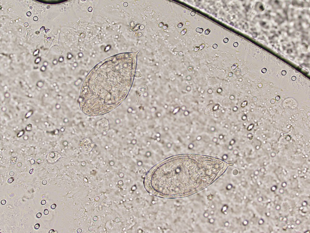 Creepy Dreadful Wonderful Parasites