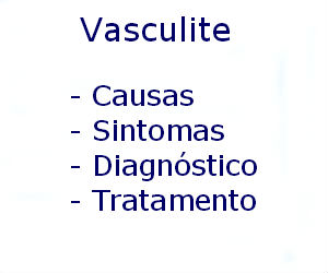 Vasculite causas sintomas diagnóstico tratamento prevenção riscos complicações