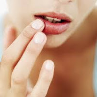 Cara Perawatan Bibir Kering dan Hitam Cara Perawatan Bibir Kering dan Hitam