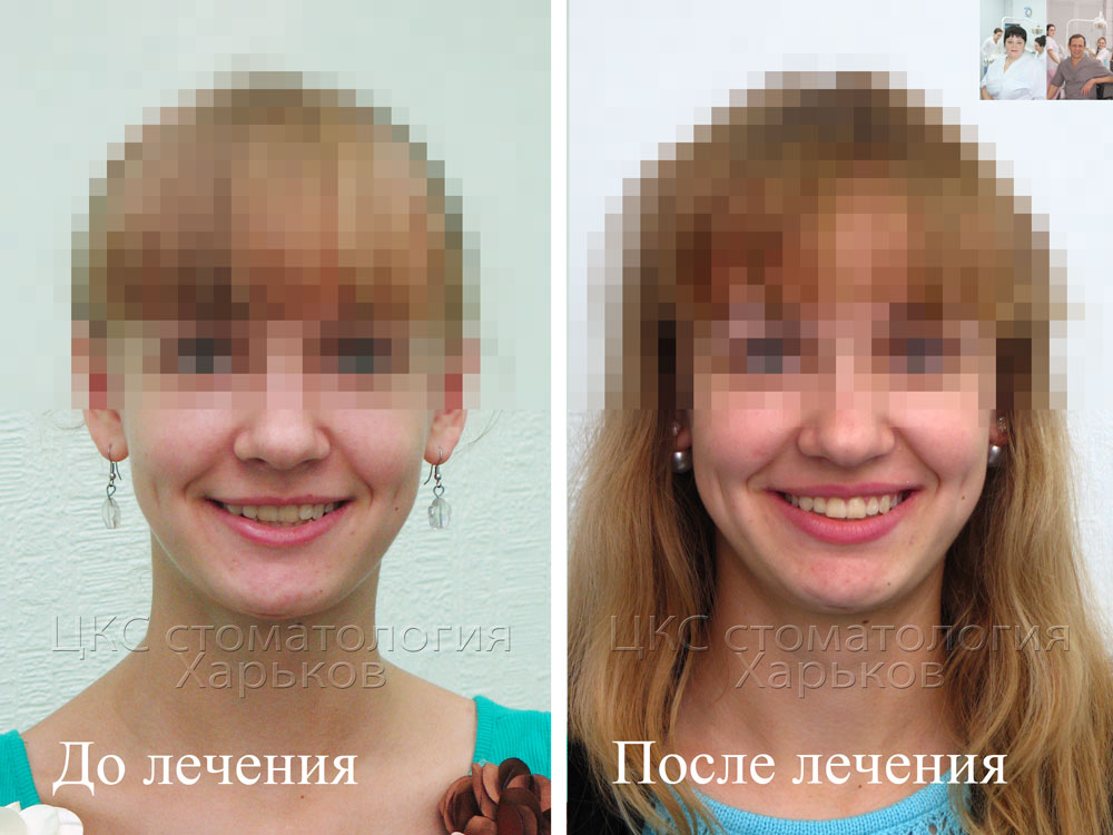 О стоматологии и не только...: Ортодонт