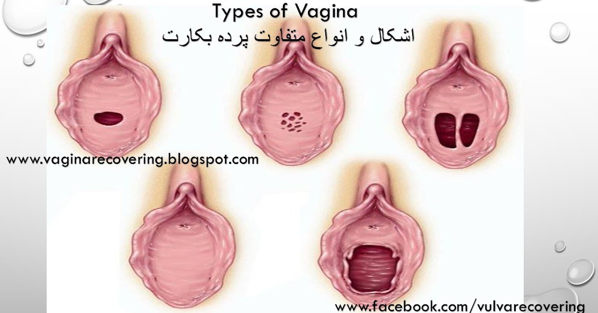 Vagina Recovering 99    Different Forms -4696