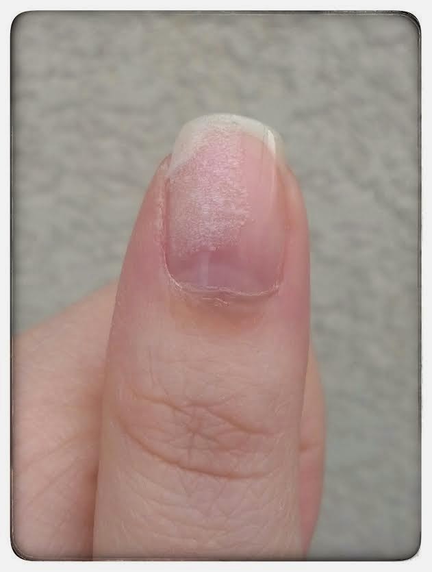 Comment réparer un ongle cassé ? 