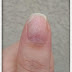 Comment réparer un ongle cassé ?