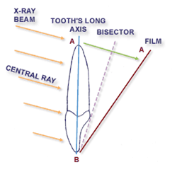 paralleling technique