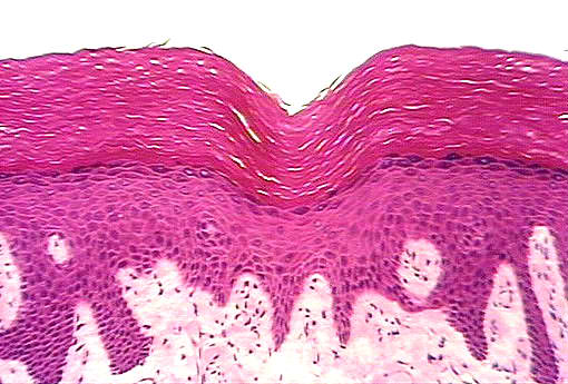 histology slide of non keratinized epithelium