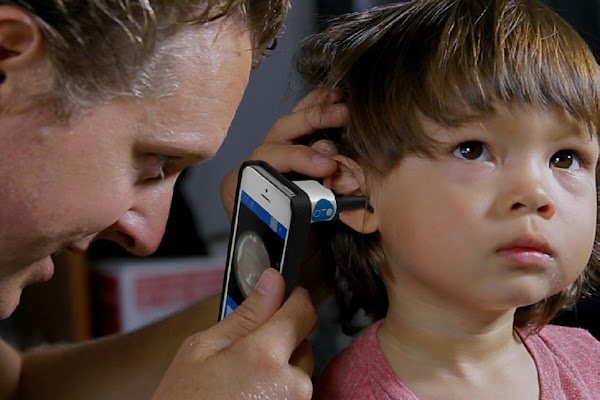 數位時代翻攝自 CellScope 官網