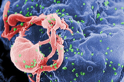 Assembling and budding of HIV virus (in green) on body cells