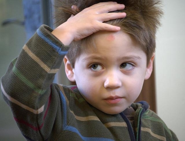 La ninos en golpes en cabeza los