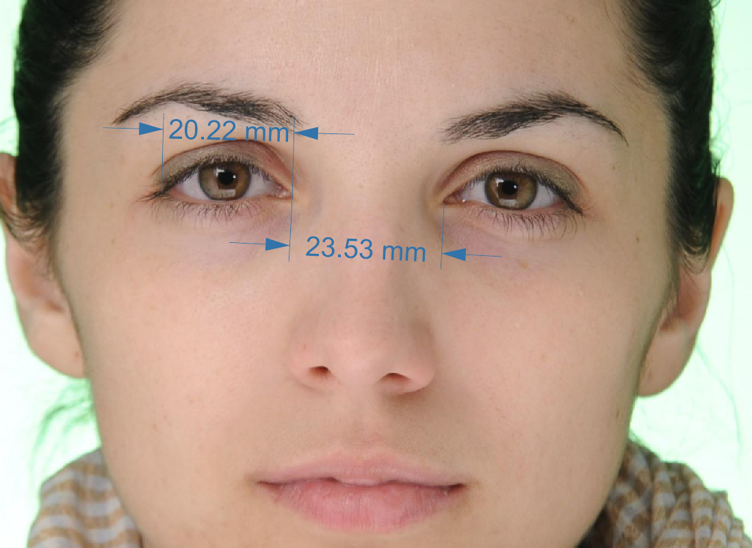 Creating a Database for WideCloseNormal Eyes