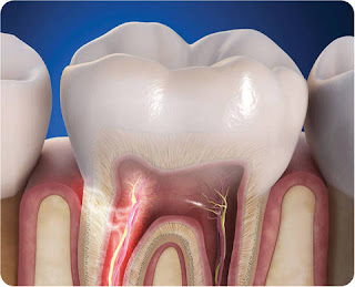 que faire pour soulager des dents sensibles