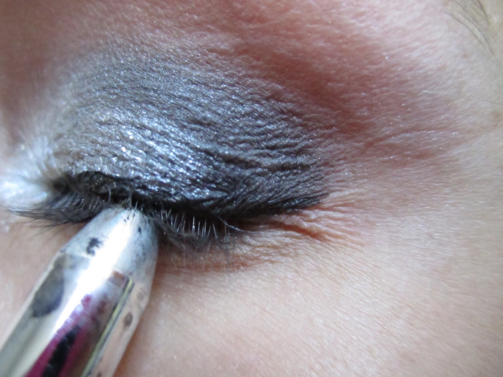 Petit Bouton Blanc Au Ras Des Cils Inférieur