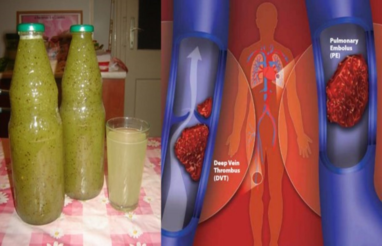 This Will Shock You, But This Juice Successfully Prevents Cancer