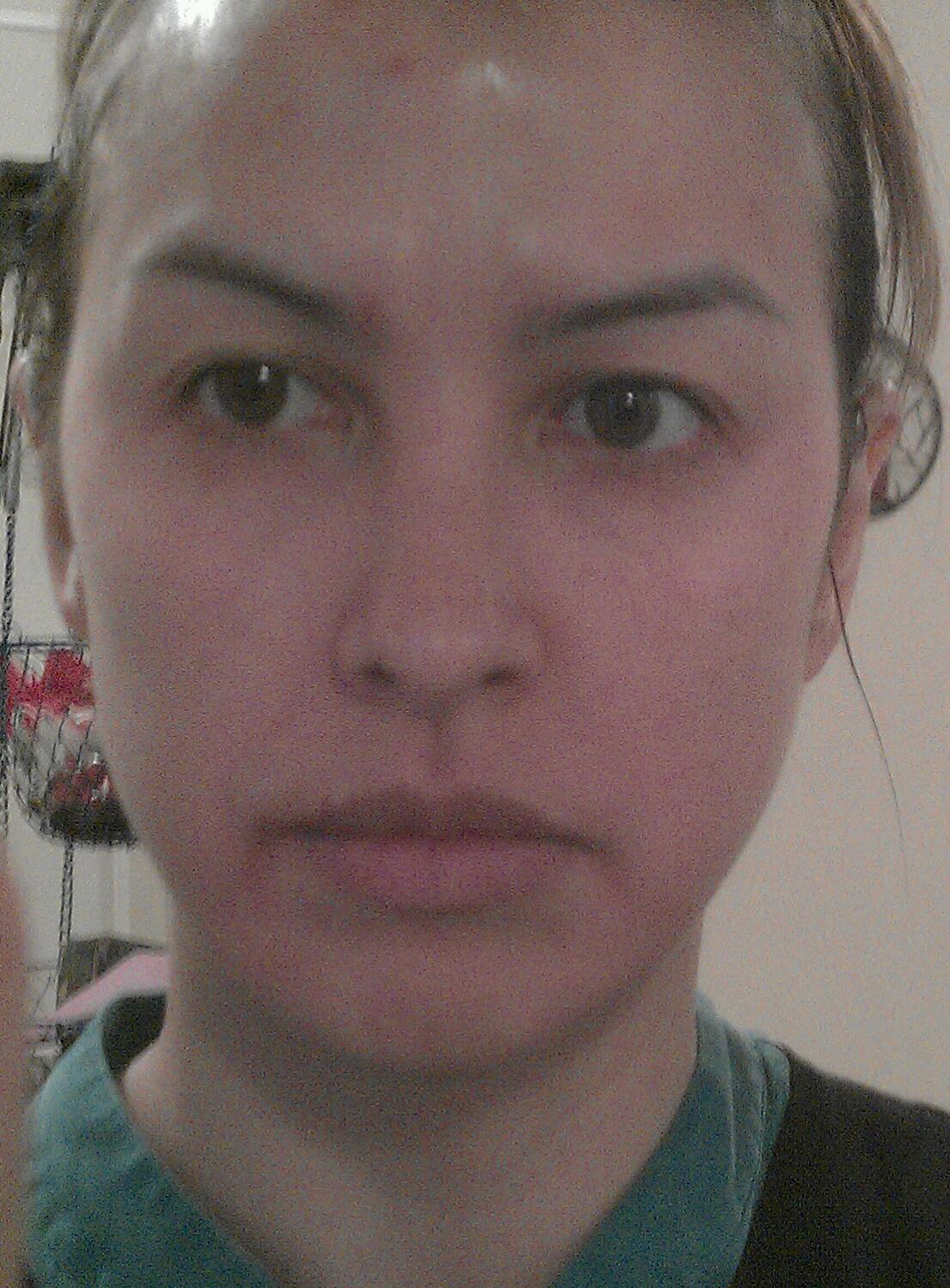 obagi nu derm week 4