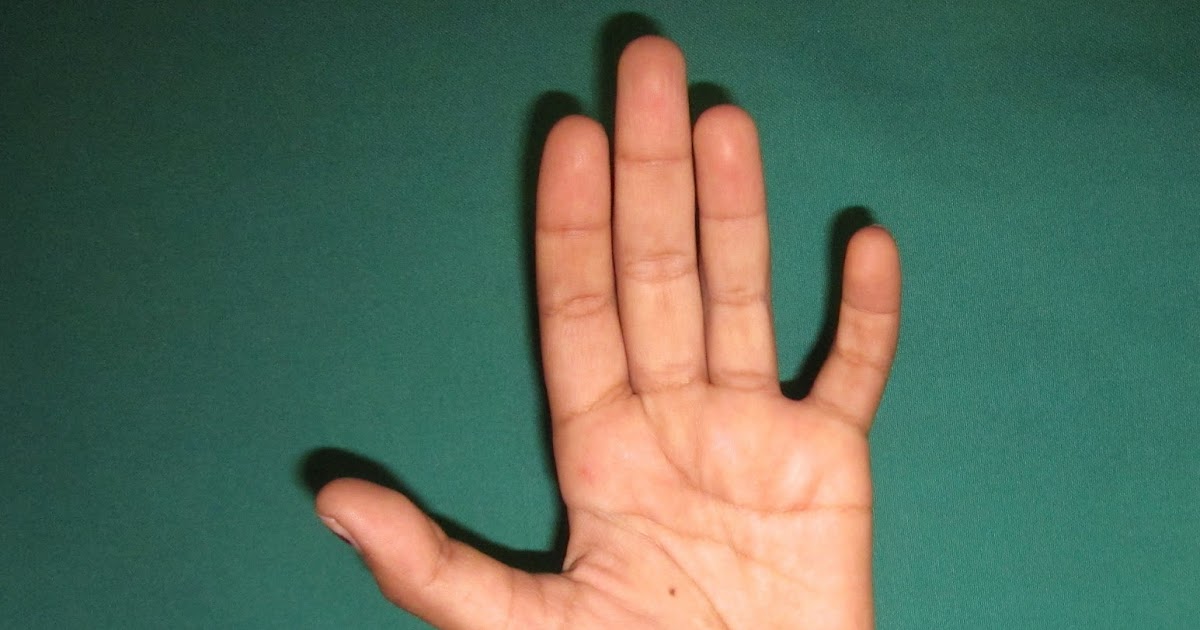 CRUSH INJURIES OF HAND AND UPPER LIMB INJURIES ULNAR NERVE INJURY