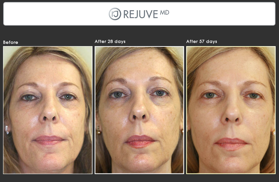 Rejuve MD [FACE]
