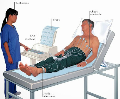cfhg358ecg_001 Tiada Hari Tanpa Tawa: Pengalaman Medical Check-Up