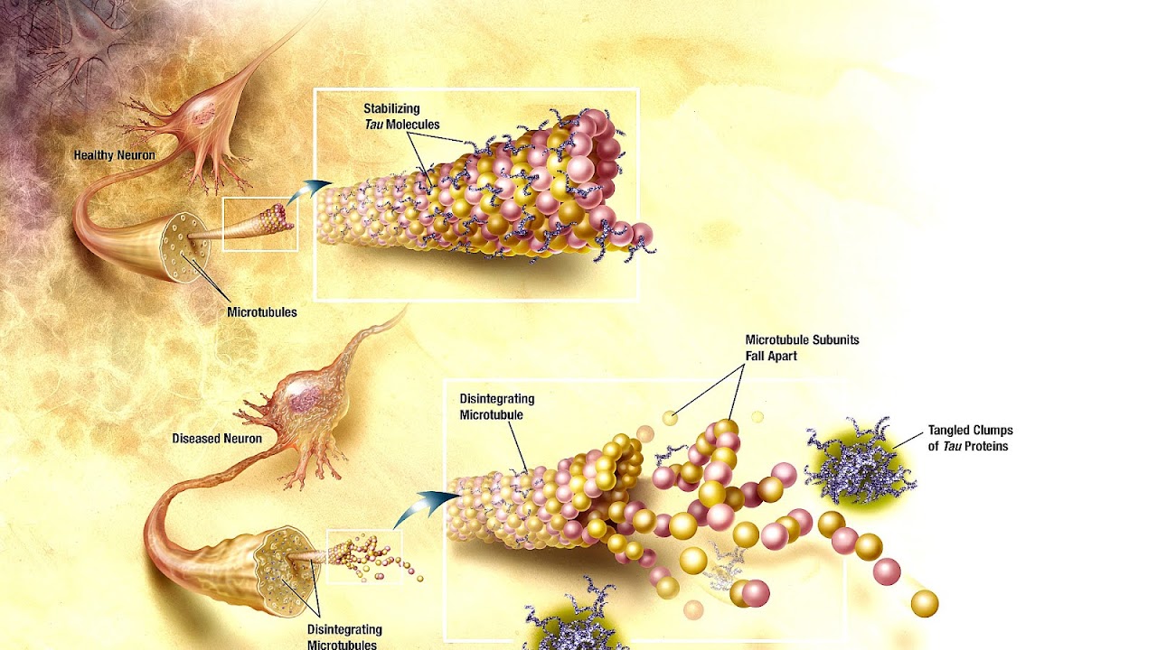 Tau protein Protein Tau Protein Choices