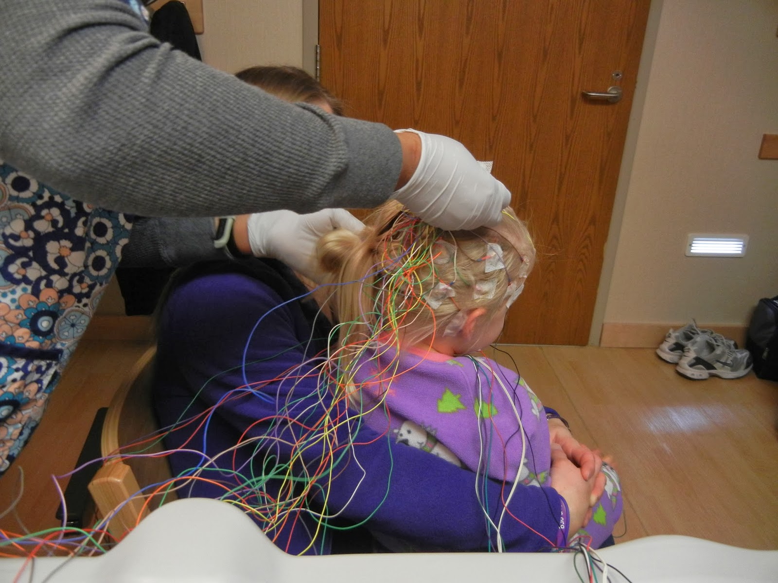 Sleep Study Eeg Lead Placement