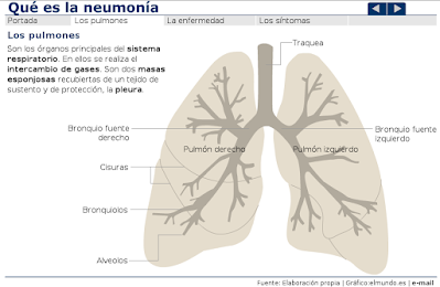http://estaticos.elmundo.es/elmundosalud/documentos/2003/03/neumonia.swf