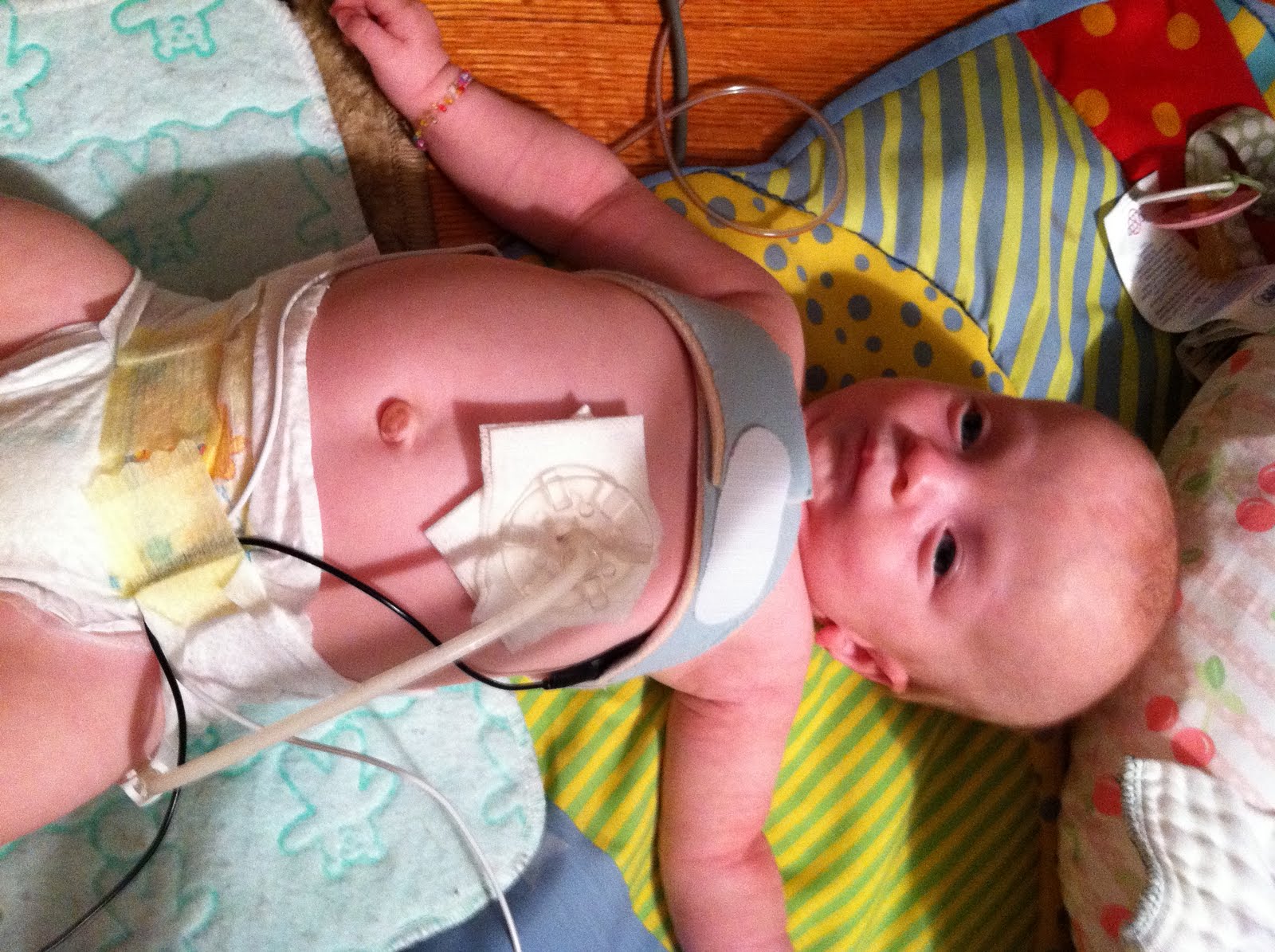 MicKey Button Mri Safety at Jessica Williams blog