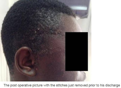 okada man stabbed in the brain robber abuja