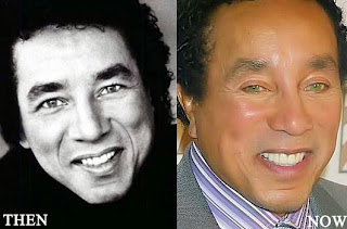 pictures of smokey robinson before and after plastic surgery